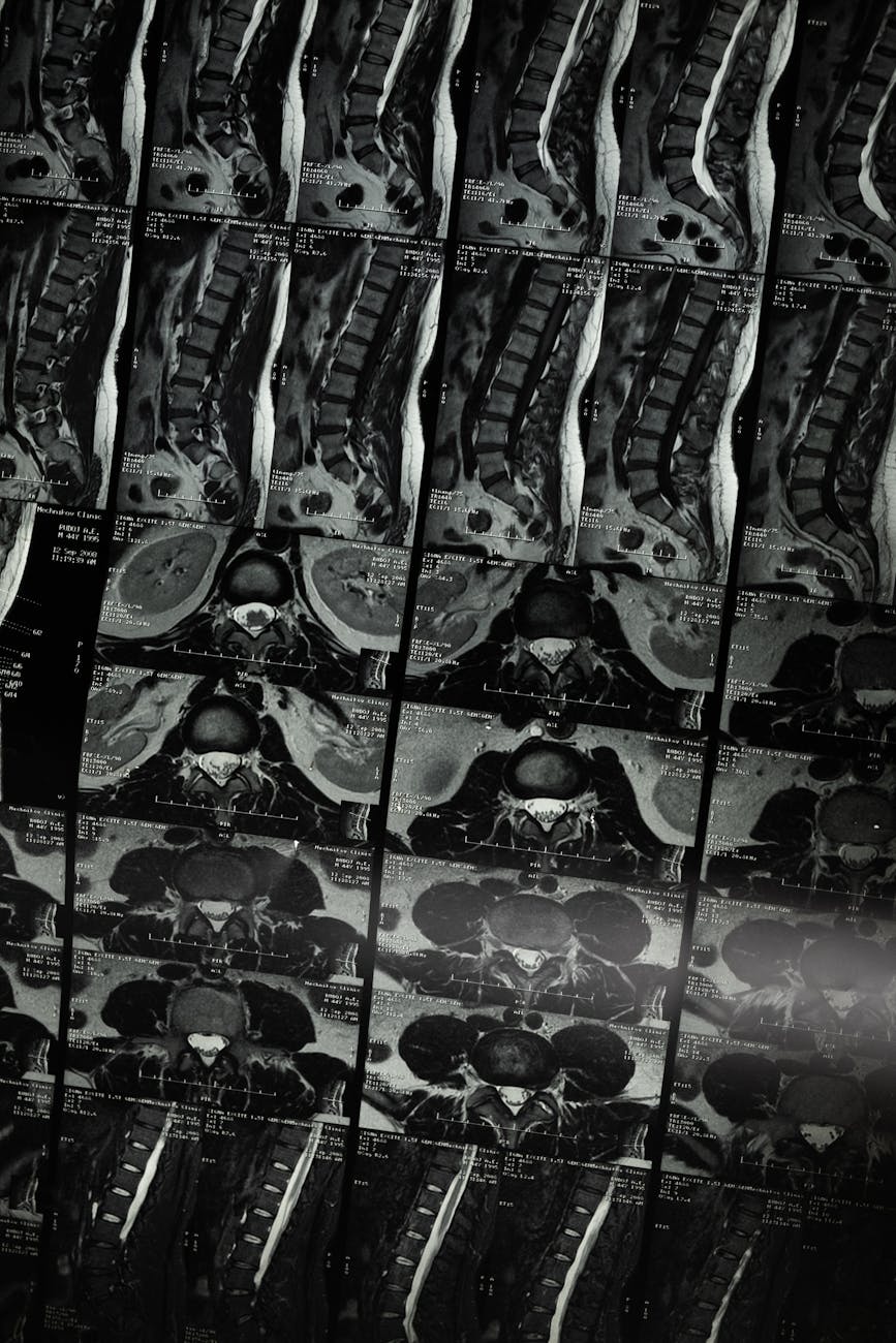 a medical imaging examination of the spine